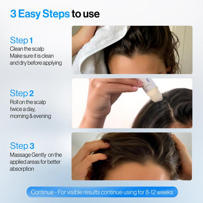 Be Bodywise Rosemary Hair Growth Serum Roll On 25 ml – 3% Rosemary, 3% Redensyl & 2% Anagain | DHT-Blocking Scalp Serum Boosts Oxygen Flow, Reduces Hair Fall | Paraben/Sulfate-Free | Women & Men